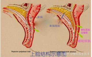 「肿泡眼」自救指南